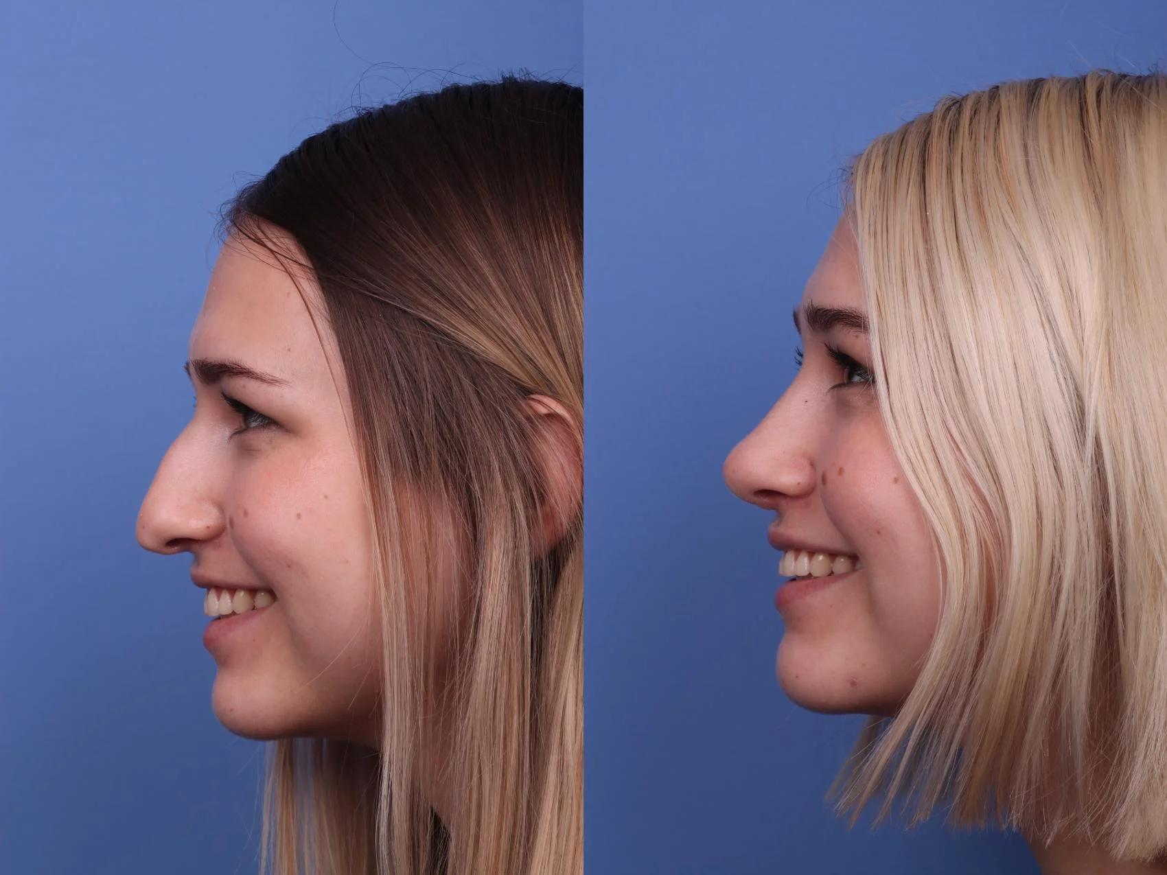 نتیجه مثبت عمل بینی