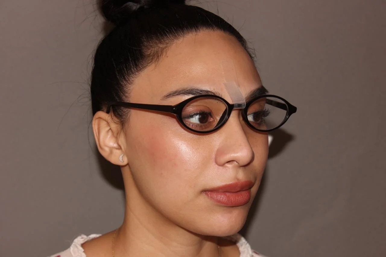 ضرورت استفاده از چسب بینی