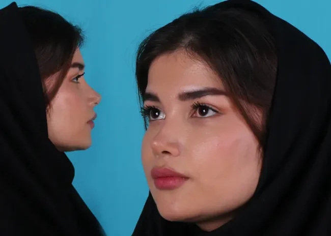 بینی-مدل-باربی-نوز