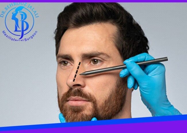 جراحی بینی مردانه جراحی بینی مردانه