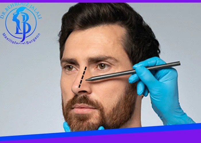 جراحی بینی مردانه