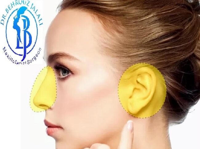 پیوند غضروف در عمل بینی پیوند غضروف در عمل بینی