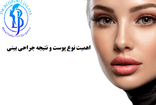 اهمیت نوع پوست و نتیجه جراحی بینی اهمیت نوع پوست و نتیجه جراحی بینی