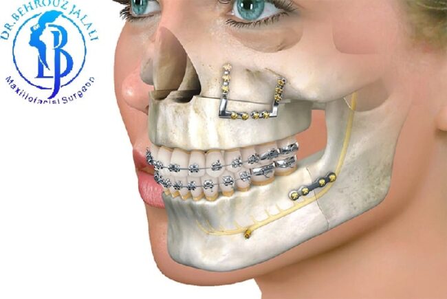 مهم ترین نکات مراقبت های بعد از جراحی مهم ترین نکات مراقبت های بعد از جراحی