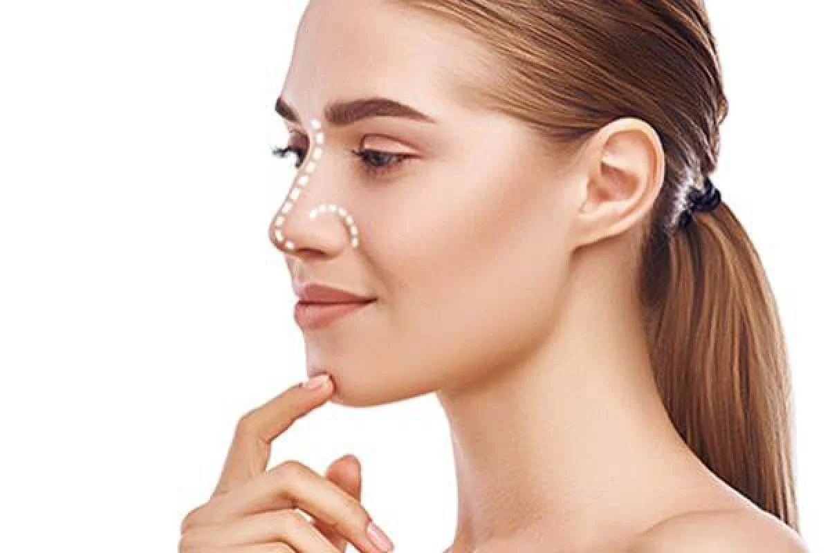 علامت گذاری بینی استخوانی