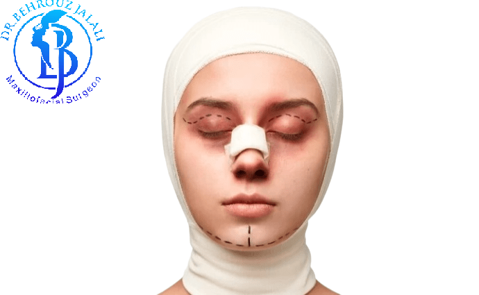 رفع کبودی چشم بعد عمل بینی